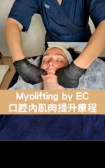 Myolifting by EC 口腔內肌肉提升療程